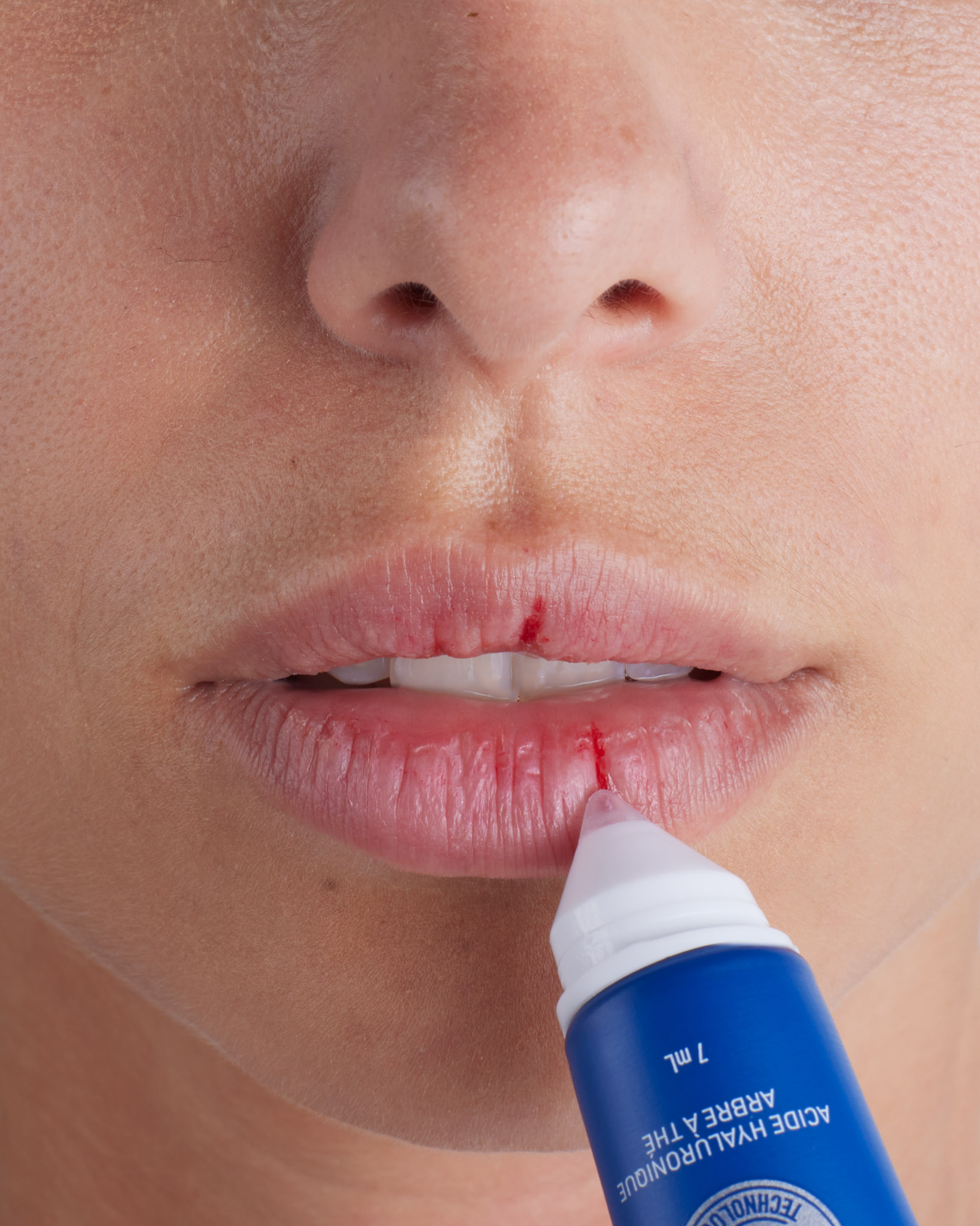 shooting cosmetique urgo<br />
produit skincare<br />
soins pour la peau<br />
soins pour les lèvres<br />
lèvres sèches<br />
soin hydratant
